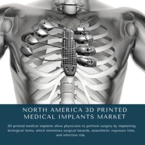 infographic: North America 3D Printed Medical Implants Market, North America 3D Printed Medical Implants Market Size, North America 3D Printed Medical Implants Market Trends, North America 3D Printed Medical Implants Market Forecast, North America 3D Printed Medical Implants Market Risks, North America 3D Printed Medical Implants Market Report, North America 3D Printed Medical Implants Market Share