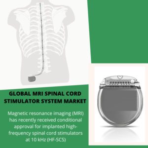 infographic; MRI Spinal Cord Stimulator Market , MRI Spinal Cord Stimulator Market  Size, MRI Spinal Cord Stimulator Market  Trends,  MRI Spinal Cord Stimulator Market  Forecast, MRI Spinal Cord Stimulator Market  Risks, MRI Spinal Cord Stimulator Market Report, MRI Spinal Cord Stimulator Market  Share