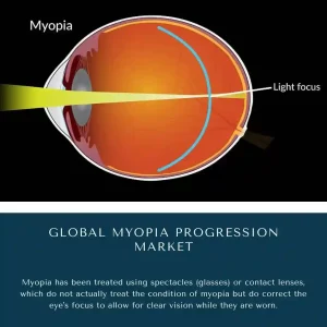 Myopia Progression Market